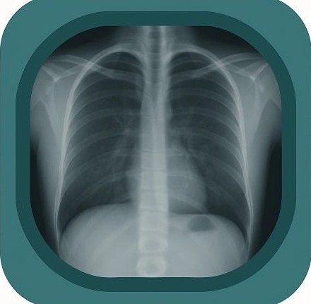 x ray chest anatomy icon